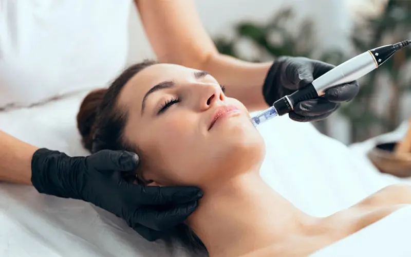 Microneedling Behandlung mit Dermapen