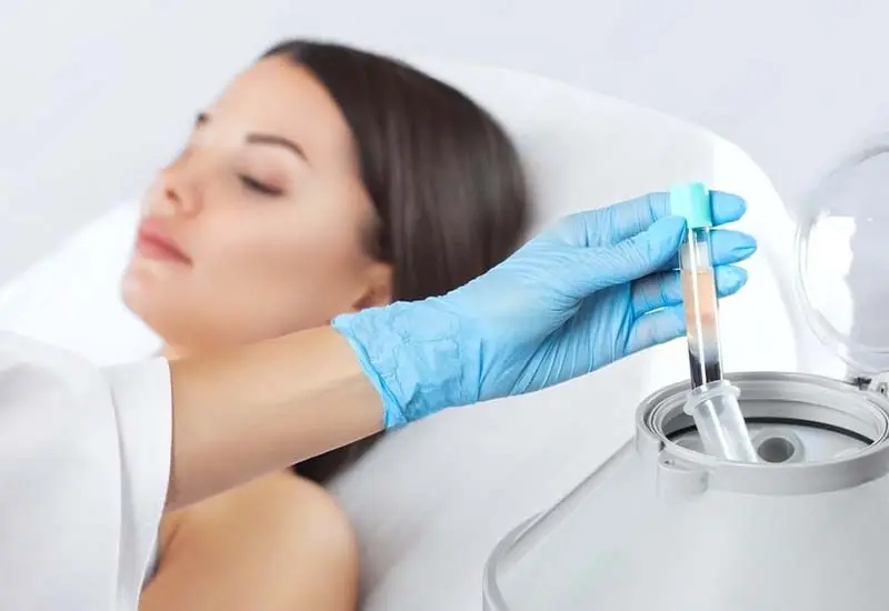 Botox Stuttgart
