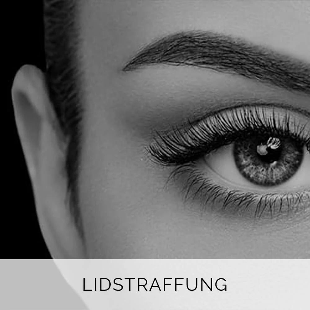 Lidstraffung