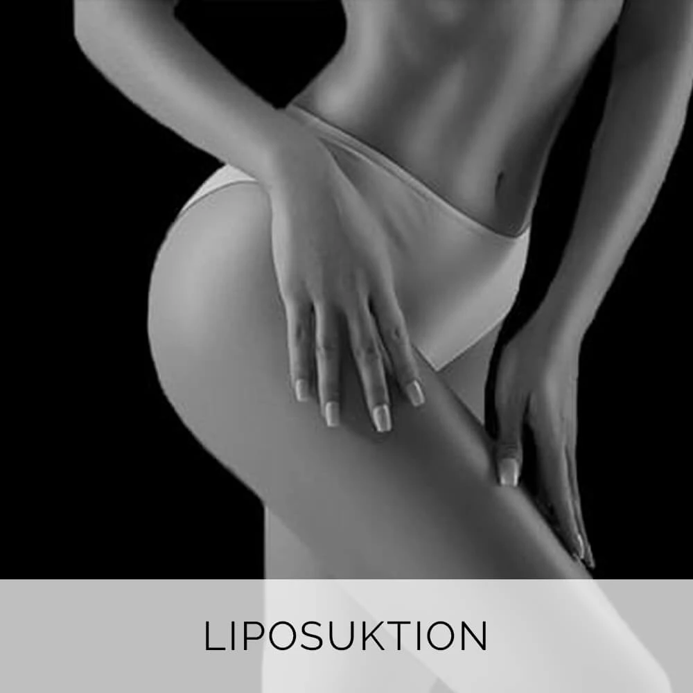 Liposuktion